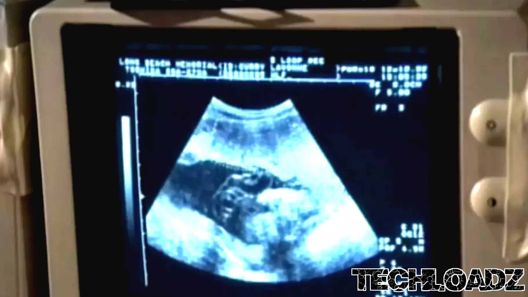 Innovative Tools at Columbia University Aim to Prevent Pregnancy Complications