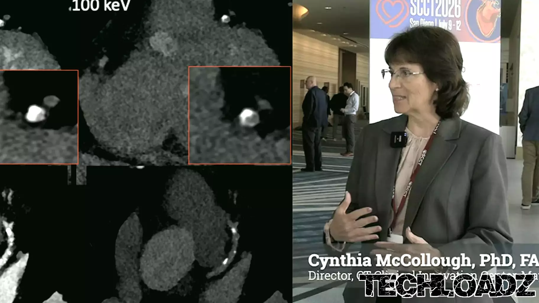 Photon-counting CT vs. conventional detector technologies