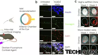 RNA technology improves insulin-producing cell transplantation outcomes